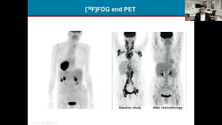 New PET Radiotracers and Targets for Imaging Neuroinflammation - Weekly Research Conference