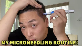 MY MICRONEEDLING ROUTINE TO TREAT HAIR LOSS!