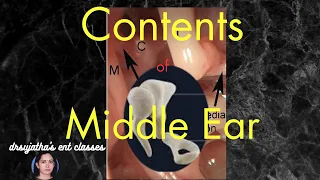 005. Middle Ear Anatomy #Contents of  Middle Ear  #Boundaries & contents of middle ear