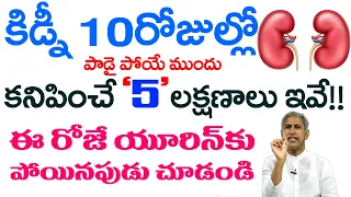 Kidney | కిడ్నీ 10 రోజుల్లో పాడైపోయే ముందు కనిపించే 5 లక్షణాలు ఇవే | Dr Manthena Satyanarayana Raju