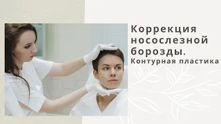 Коррекция носослезной борозды. Контурная пластика.