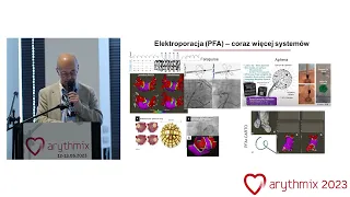 Prof. Piotr Kułakowski: Leki, ablacja i stymulacja
