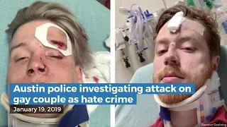 Austin police investigating attack on gay couple as hate crime