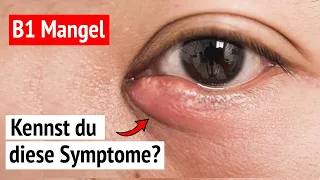 😱 B1 Mangel: Diese 5 Symptome gefährden deine Gesundheit