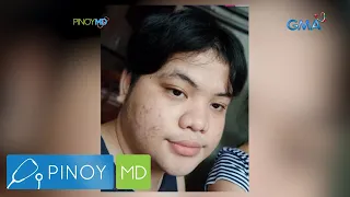 20-anyos na transwoman, sinimulan ang kanyang weight loss journey! | Pinoy MD