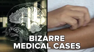 Bizarre Medical Cases That Still Confuse Doctors