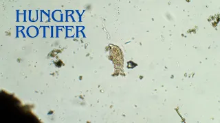 Rotifer Eating