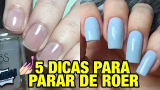 AS 5 MELHORES DICAS QUE ME AJUDARAM PARAR DE ROER UNHAS