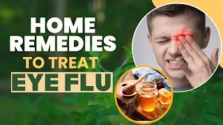 Home Remedies For Eye Flu | Home Remedies For Conjunctivitis Eyes | Eye Flu Treatment  | Eye Flu