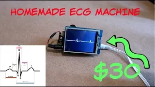 Homemade ECG Machine