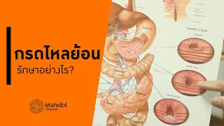 เข้าใจ "กรดไหลย้อน" ฟังคุณหมอจากศิริราชอธิบายอาการ สาเหตุ และการรักษา [หาหมอ by Mahidol Channel]