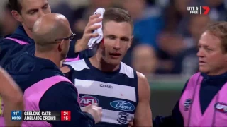 Courageous captain left bloodied - AFL