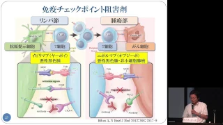 肺がんの免疫療法について　佐々木 治一郎