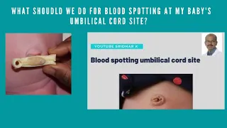 Newborn cord care after cord stump falls. #cordcare #bellybutton #bloodspotting