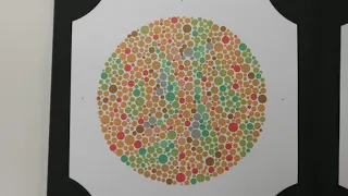 Video 6: The Ishihara Test for Colour Vision