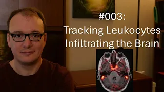 003 - Tracking Leukocytes Infiltrating the Brain