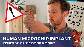 HUMAN MICROCHIP IMPLANT - NFC-chip in hand, issues (3x) criticism (3x) & more | Peter Joosten MSc.