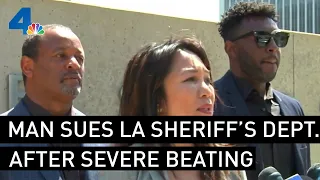 Civil Rights Lawsuit Accuses LA Sheriff's Deputies of Severely Beating Man | NBCLA