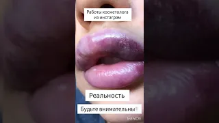 Не ведитесь на дешёвые цены!!! Будьте внимательны при выборе косметолога в инстаграме!