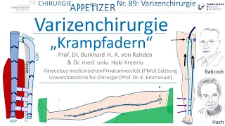 Varizenchirurgie Krampfadern CHIRURGIE APPetizer Nr. 89