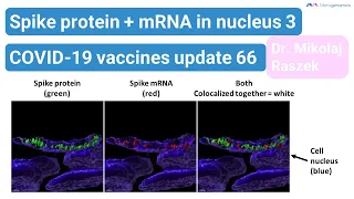 Spike protein and mRNA in nucleus 3 - NEW EVIDENCE - COVID-19 vaccines update 66