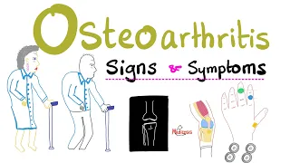 Osteoarthritis (OA) Part 4: Signs and Symptoms