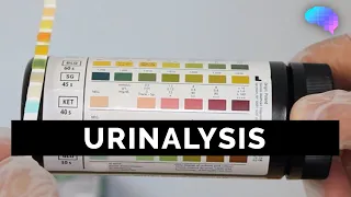 Urinalysis - OSCE Guide (old version) | UKMLA | CPSA