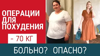 ОЧЕНЬ БОЛЬНО | ОПАСНЫЕ ОПЕРАЦИИ ДЛЯ ПОХУДЕНИЯ | РЕЗЕКЦИЯ ЖЕЛУДКА | ОТЗЫВ | ОТВЕЧАЮ НА ВОПРОСЫ