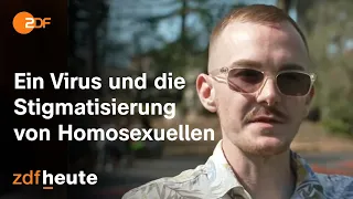 Affenpocken in den USA und die Diskriminierung homosexueller Männer I auslandsjournal