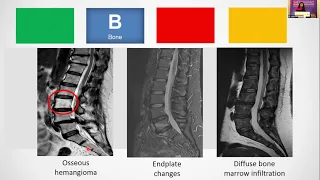 Interpreting MRI of the spine As simple as ABCD