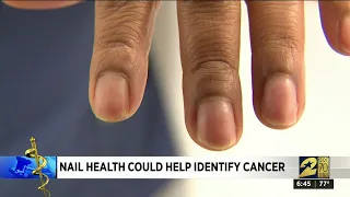 Nail health could help identify cancer