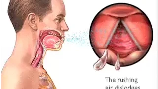 How Do We Cough? - The Mechanism of Coughing - Cough Reflex Animation - Learn Human Body