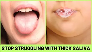 How To Get Rid Of Thick Saliva Fast? Try These Proven Techniques