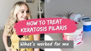 How to treat Keratosis Pilaris | What's worked for me