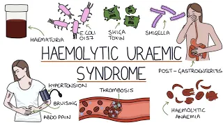 Haemolytic Uraemic Syndrome | Drk