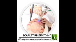 Микроигольчатый RF-лифтинг Scarlet