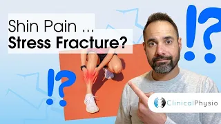 Is Your Shin Pain a Stress Fracture? | Expert Physio Guidance