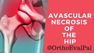 Avascular Necrosis of the Hip:Explained by Paul at Ortho Eval Pal