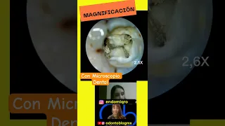 Magnificación con Microscopio Dental 🦷 🔍👁️ #shorts #microscopio #microscopiodental #odontologia