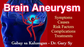 Brain Aneurysm - Dr. Gary Sy