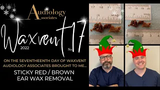 STICKY RED / BROWN EAR WAX REMOVAL - EP702