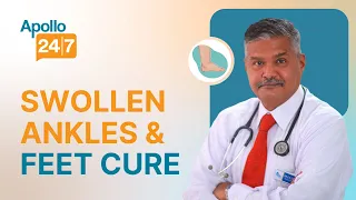 Swollen Ankles & Feet: Causes and Cure? | Dr S K Sahoo | Apollo 24|7