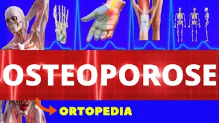 OSTEOPOROSE - O QUE É, CAUSAS E SINTOMAS - TUDO SOBRE OSTEOPOROSE - ORTOPEDIA