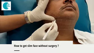 How to get a slim face in 10 min without surgery
