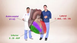 ECG for Beginners. ECG Diagnosis of ST Elevation Myocardial Infarction (STEMI)