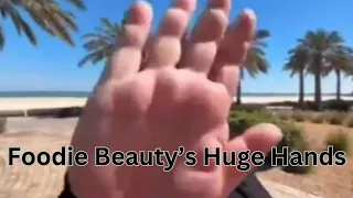 Foodie Beauty's Big Hands Sign Of Poor Health?