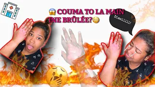 STORYTIME: Couma mo la main ine brûlée😔