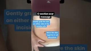 C-section Scar Massage