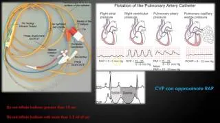 Hemodynamic Monitoring Part 1