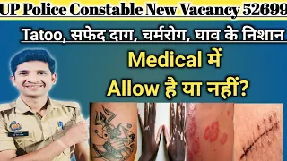 UP Police Constable Vacancy 2023 | Medical | Tatoo allow है या नहीं? @Exampur__Official